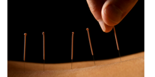 Acupunctuur na de bevalling